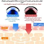 دستگاه ماساژور وی فیس لیفتنگ غبغب و جوانسازی