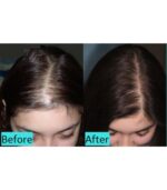 کوکتل درماهیل HL تقویت موی سر اصل کره جنوبی Dermaheal HL Hair Regain Mesuthrapy Solution