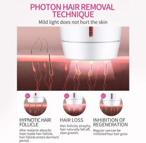 دستگاه لیزر خانگی حرفه ای رفع موهای زائد صورت و بدن آی پی ال با 800000 شات IPL Laser Hair Removal Handset